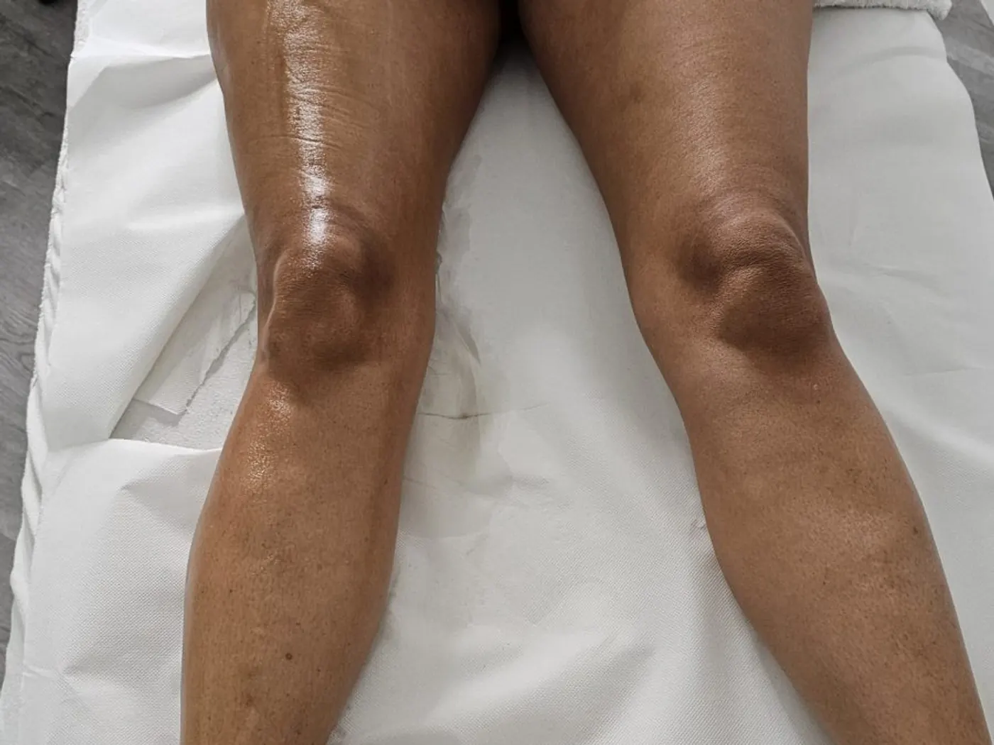 Jambes posées sur le drap d’examen de la table de soin, en lumière de plafonnier.